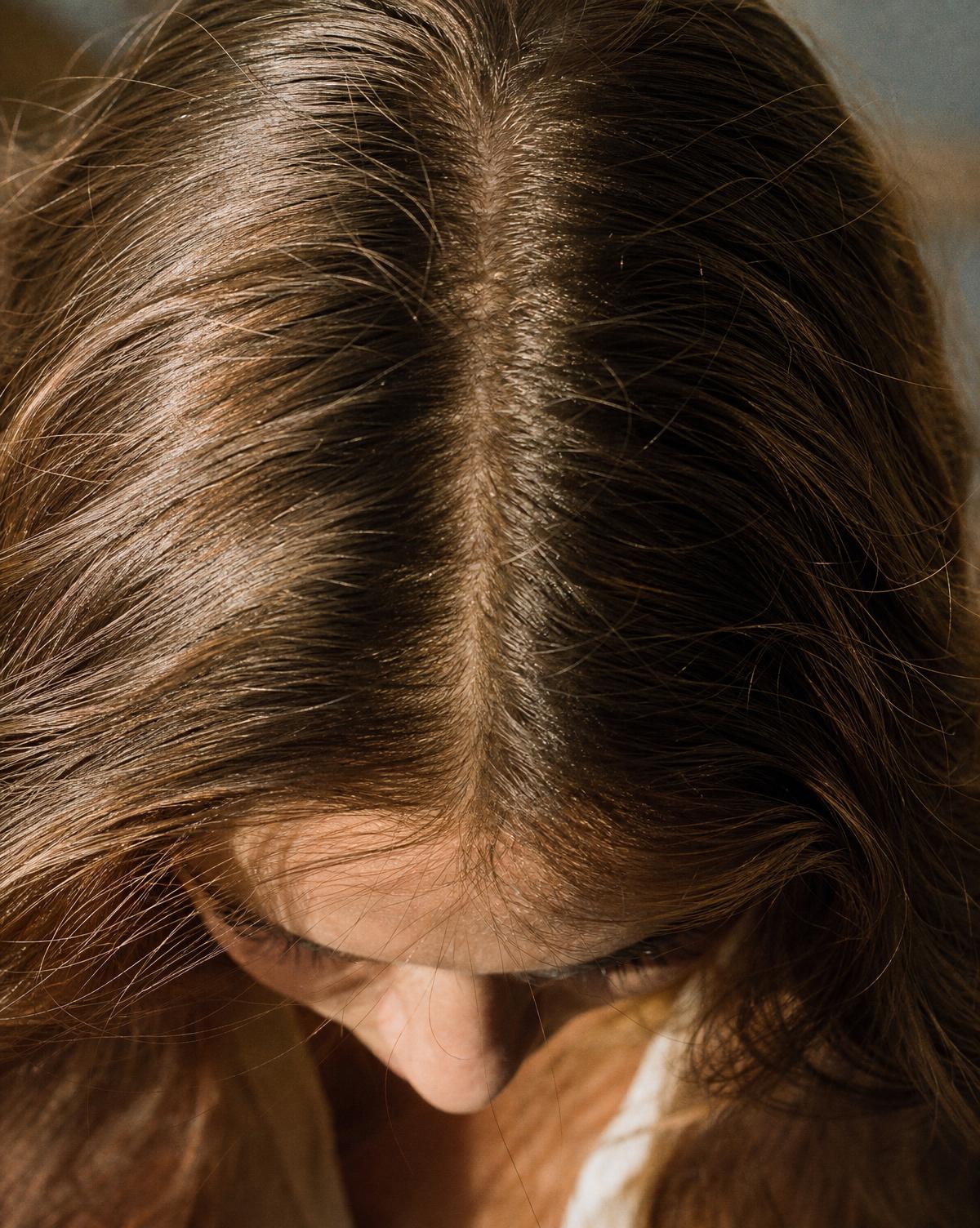 PRP for Hair Restoration