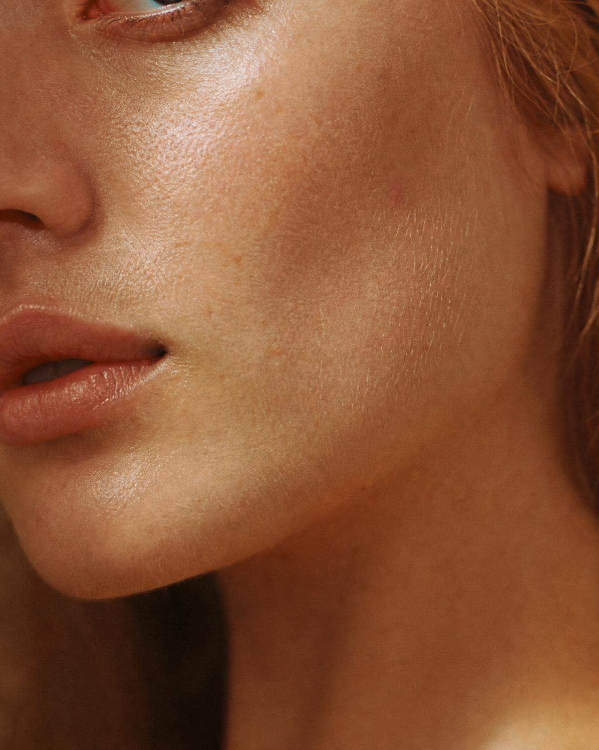 Micro-Needling